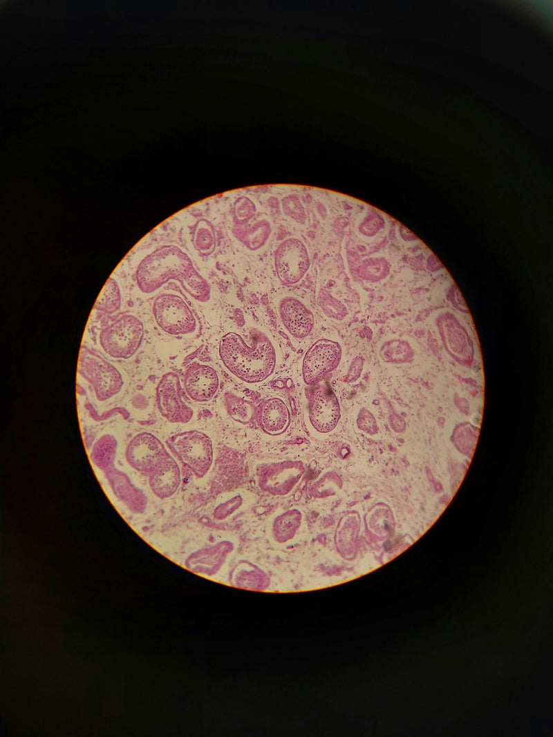 Selective Senolysis: Clearing “Zombie Cells” in Humans